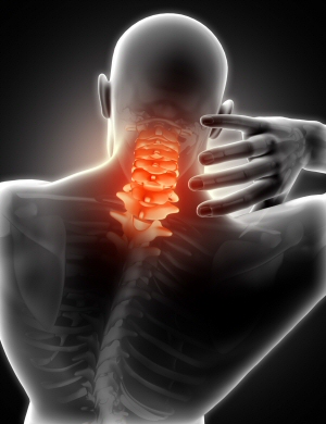 Cervical Spondylosis - Neck pain